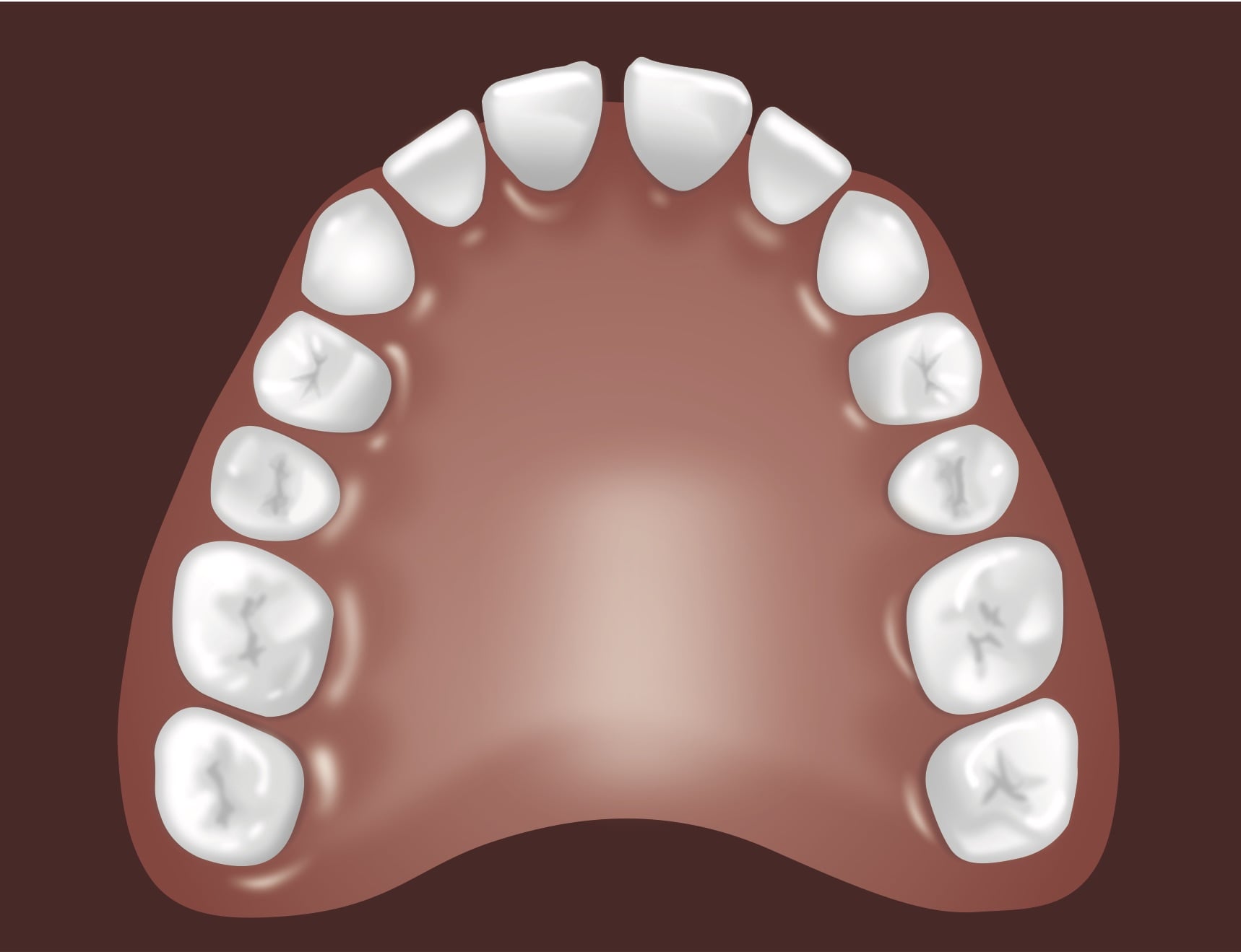 Dental arch diagram showing upper teeth arrangement in proper alignment for orthodontic treatment.