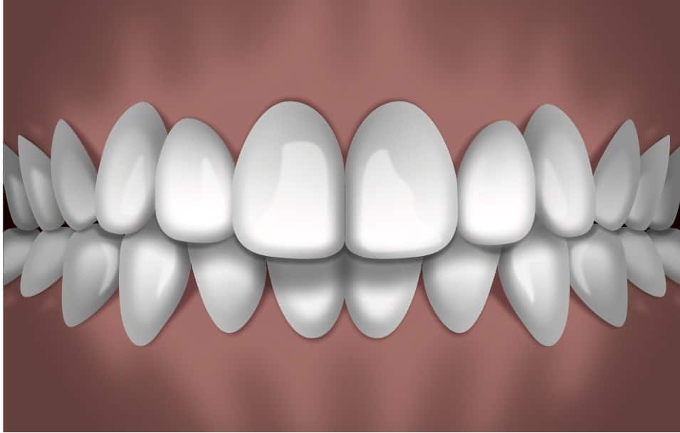 Digital dental illustration showing properly aligned upper and lower teeth in white against a brown background.