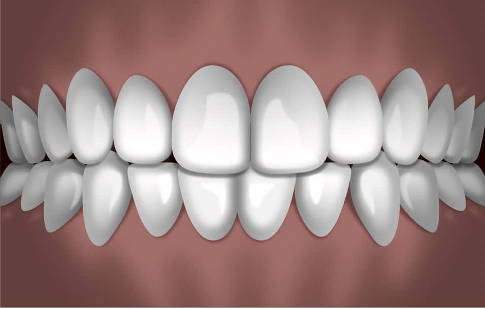 Perfectly aligned white teeth in ideal bite position, demonstrating orthodontic treatment results.