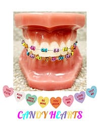 Orthodontic model displaying colorful candy heart braces with matching decorative hearts below.