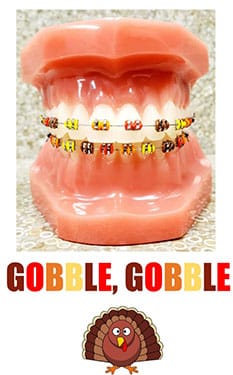 Open mouth model displaying colorful orthodontic braces with "Gobble, Gobble" text below.