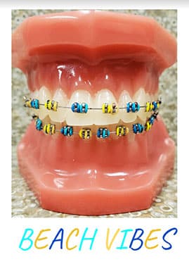Colorful braces on pink dental model with "Beach Vibes" text below