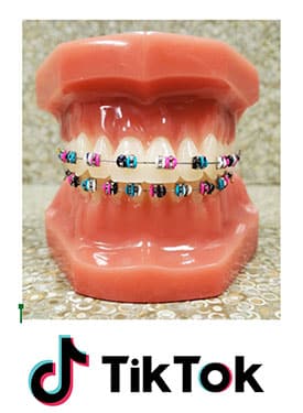 Dental model wearing colorful braces with TikTok logo below on textured background.