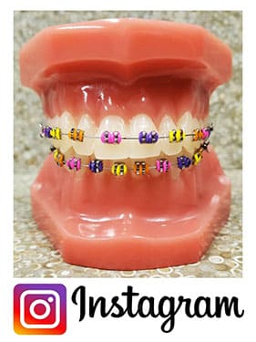 Dental model displaying colorful orthodontic braces with Instagram logo below, promoting orthodontic services.