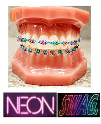 Dental model displaying colorful braces with neon "SWAG" text overlay for orthodontics practice.