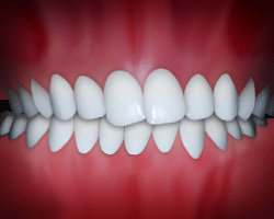 Perfectly aligned white teeth in ideal bite position against pink gum background.