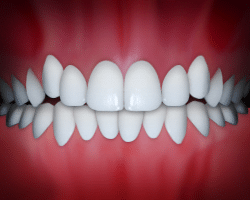 Perfect white teeth alignment displayed in dental bite view against red gum background.
