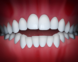 Perfect white teeth alignment displayed against red background for orthodontic treatment showcase.