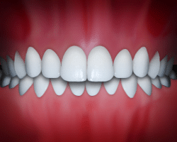 Perfectly aligned white teeth displayed in ideal bite alignment against red gum background.