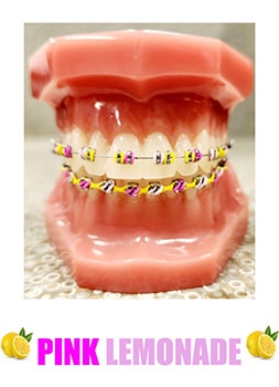Dental model displaying colorful braces with yellow and multicolored bands on teeth.