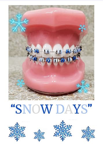 Large pink tooth model displaying blue braces with "SNOW DAYS" text and snowflake decorations.