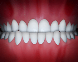 Perfectly aligned white teeth displayed in a frontal view against a red gradient background.