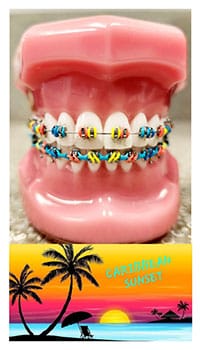 Orthodontic teeth model with colorful braces displayed on tropical sunset background packaging.