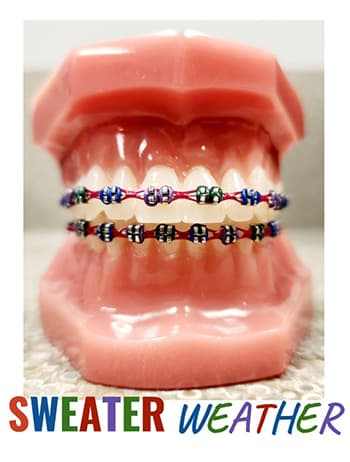 Dental model wearing blue and silver braces with "Sweater Weather" text overlay for orthodontics marketing.