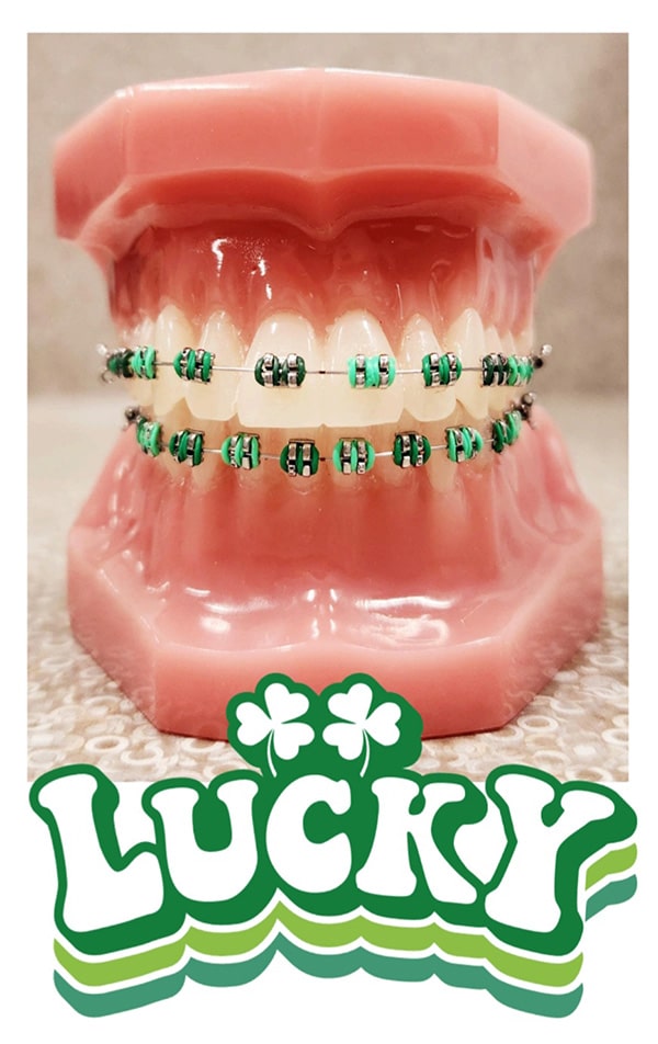 Dental model wearing green and silver braces with "Lucky" text below, orthodontics demonstration.